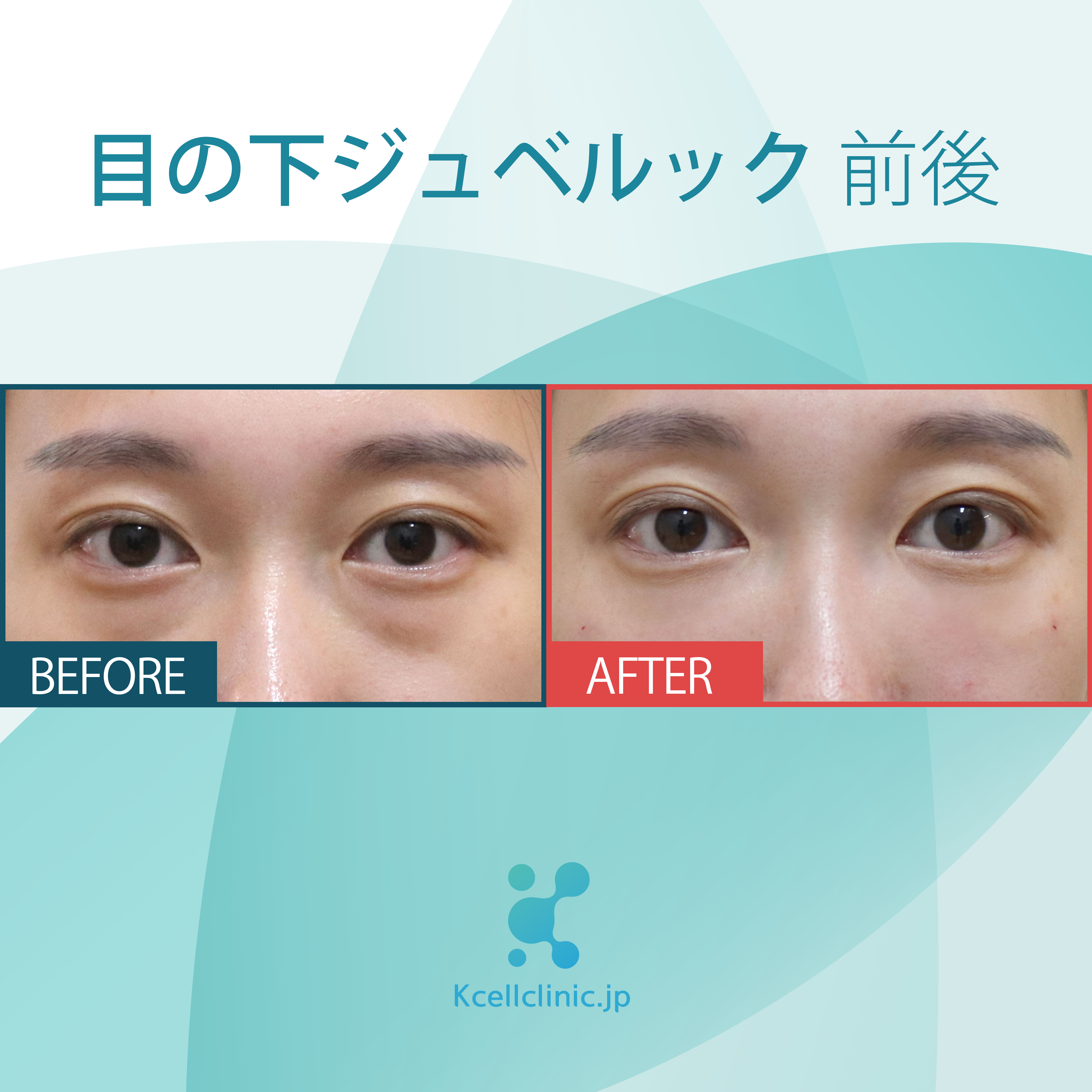 症例写真3